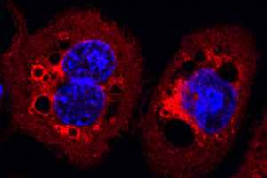 Neue Funktion von antibiotikaresistenten Bakterien entdeckt