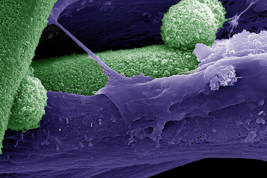 Überdosis Calcium: Nanokristalle beeinflussen die Differenzierung von Stammzellen während der Knochenbildung